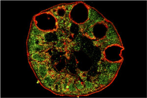 For some, GI tract may be vulnerable to COVID-19 infection